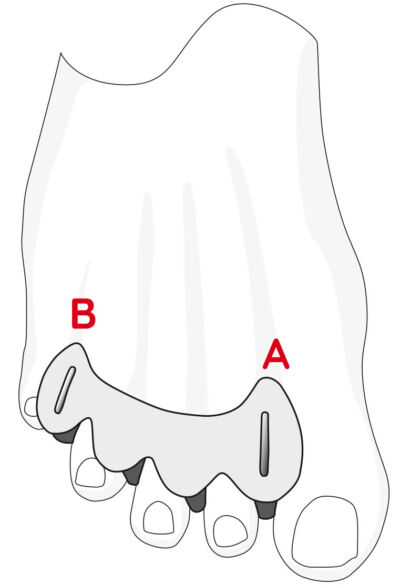 KT_SizingDiagramToeSpacer2