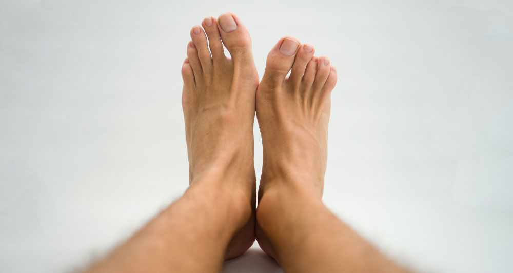 a photo of someone who has a large difference between the size of their feet